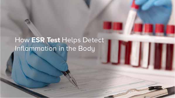 How ESR Test Helps Detect Inflammation in the Body